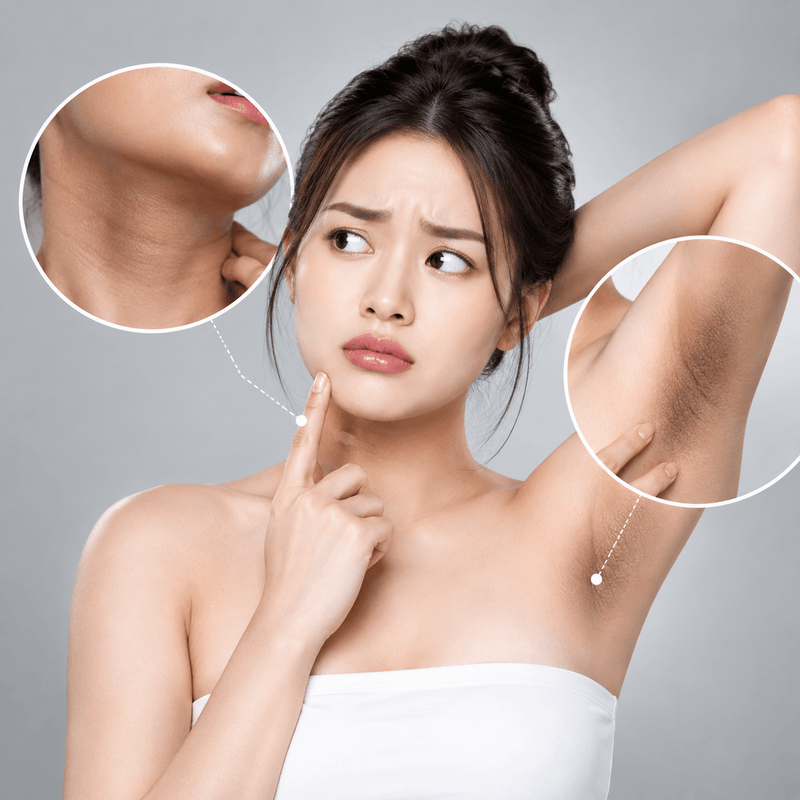 Kulit Menggelap di Leher dan Ketiak? Bisa Jadi Ini Penyebabnya - elmaskin.id