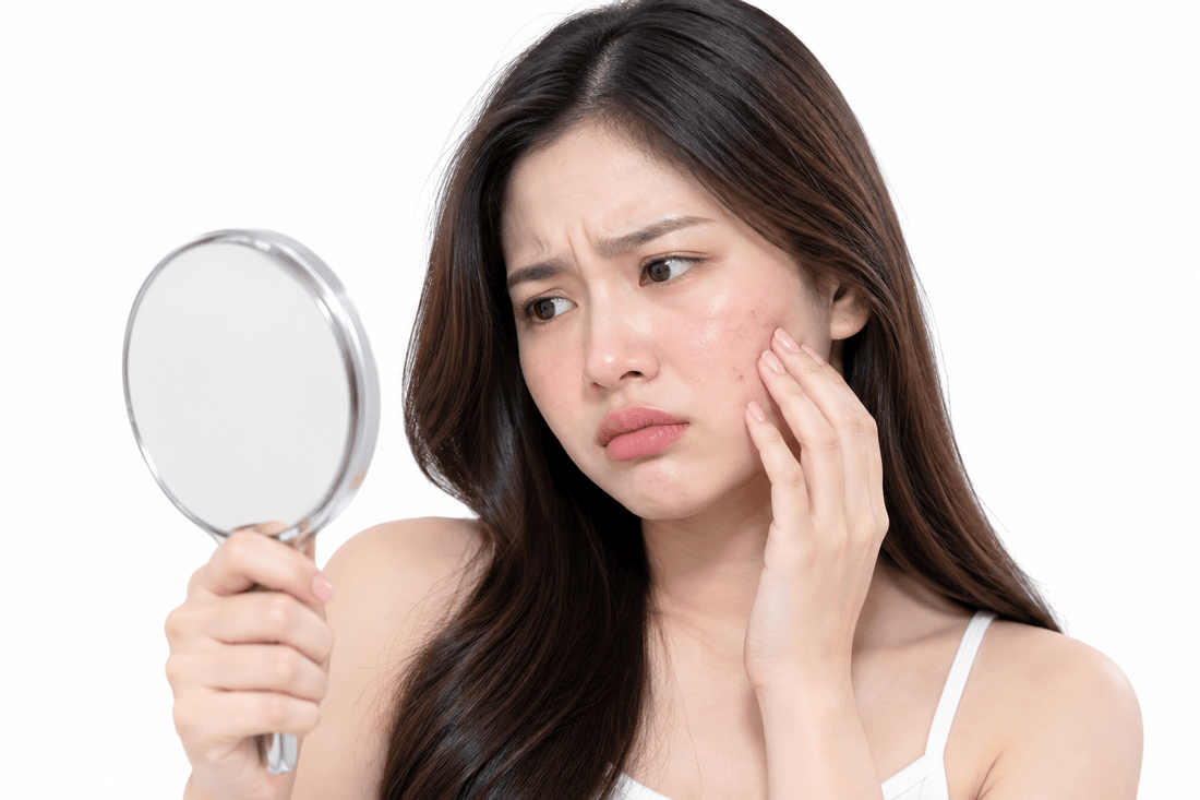 Niat ingin putih, tapi malah berakhir zonkk! - elmaskin.id