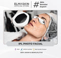 IPL Photo Facial For Acne