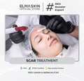AQ Treatment - elmaskin.id