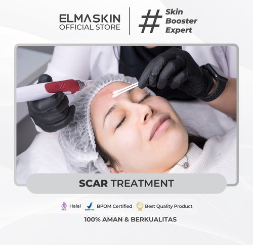 AQ Treatment - elmaskin.id