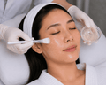 Facial Acne Refining - elmaskin.id