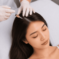 Hair Growth PRP - elmaskin.id