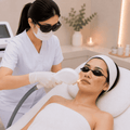 Laser Hyperpigmentasi - elmaskin.id
